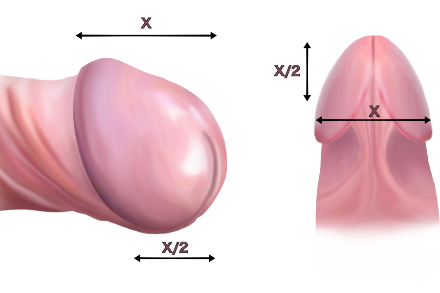 Plastie de gland